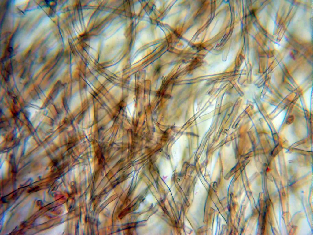 Microscopía de Phlebiopsis friesii - 10 - Hifas x 400